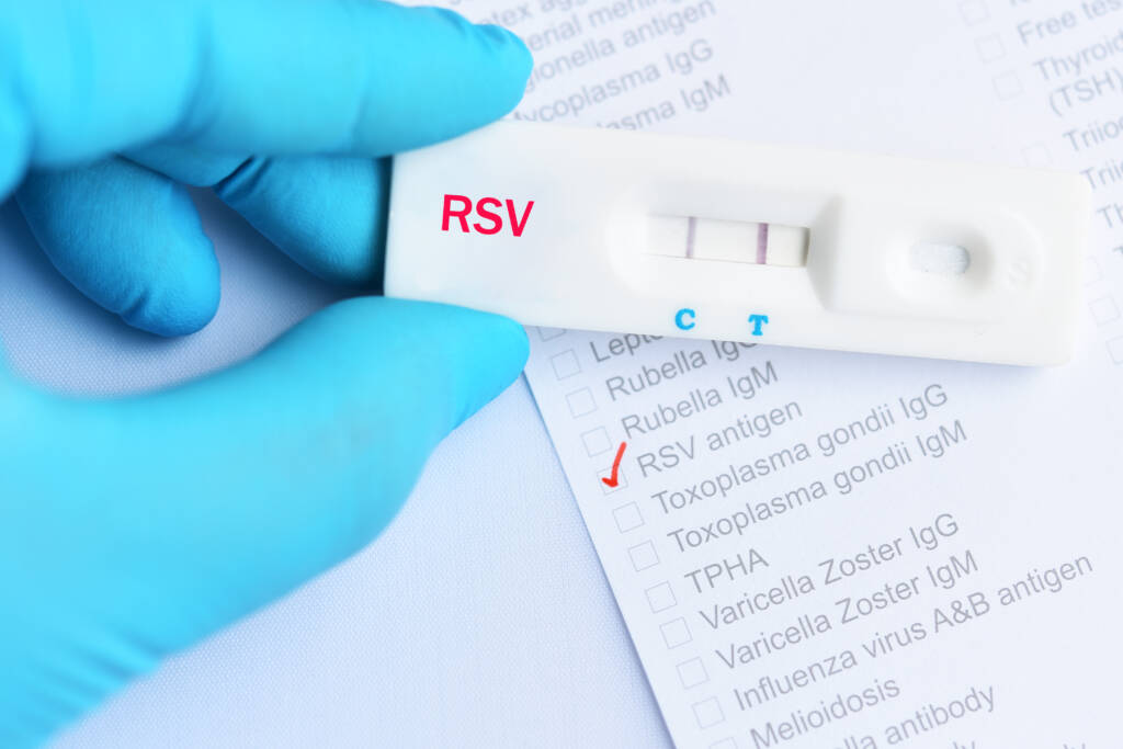 RSV rapid test from BIOMED for the reliable detection of the RS virus within 15 minutes